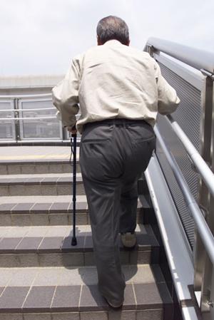 若々しい暮らしを期待出来るインプラント